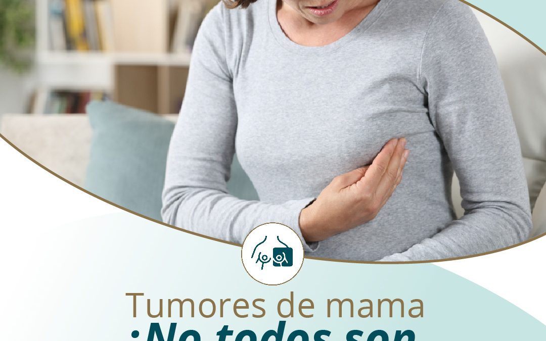 tumores de mama